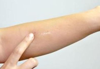 上海新星整形美容醫(yī)院——醫(yī)生團隊、價格透明一目了然!