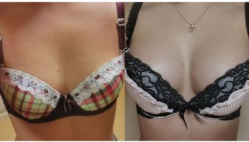 湖南地區(qū)雙眼皮手術(shù)醫(yī)生排行榜單盛裝亮相！提供熱門名醫(yī)推薦供您選擇！