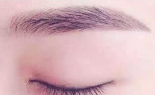 杭州頂級(jí)發(fā)際線修復(fù)醫(yī)院盤點(diǎn)，全方位權(quán)威排行發(fā)布，看看有沒有你心儀的醫(yī)院選擇