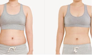 協(xié)和醫(yī)院提供熱瑪吉和超生炮手術，專家推薦！手術費用一覽表僅參考！