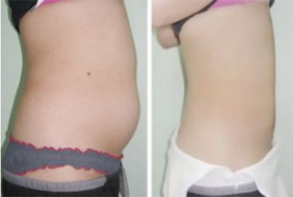 長沙哪家拉皮手術(shù)醫(yī)院靠譜？幾家實力口碑不錯，快來看看