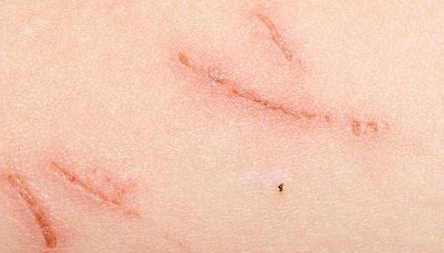 南京華美美容醫(yī)院引薦專(zhuān)業(yè)吸脂醫(yī)生