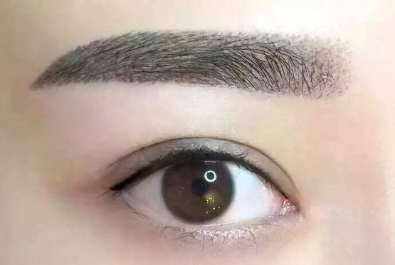 李發(fā)成整容之精彩案例分享，認(rèn)識中國醫(yī)學(xué)科學(xué)院整形外科醫(yī)院