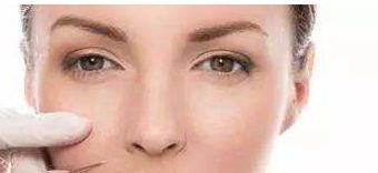 浙醫(yī)二院薛旦雙眼皮效果及價(jià)格詳情，醫(yī)生特長(zhǎng)與病例分享