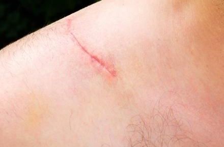 全國隆鼻專家排行榜發(fā)布！實力專家揭秘，經驗豐富！