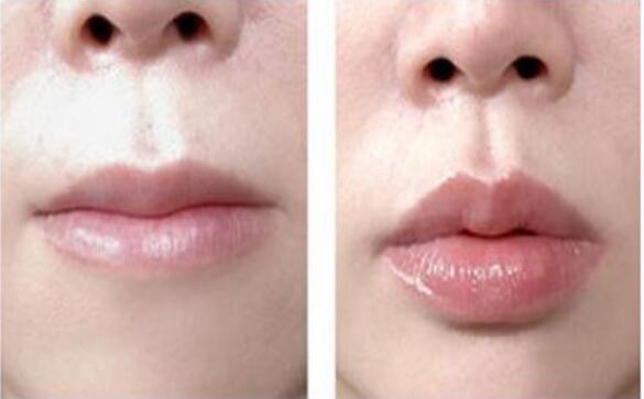 北京柏麗整形醫(yī)院的整形效果如何？有哪些專家醫(yī)生可以選擇？