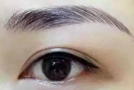 各路醫(yī)生實(shí)力大比拼！同帥與楊亞益，誰在雙眼皮手術(shù)上更出彩？