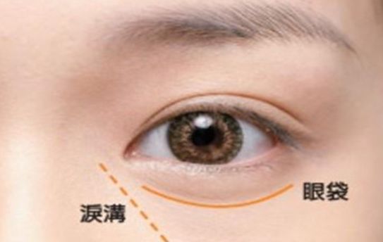 寧波最佳假體隆鼻醫(yī)院推薦及患者口碑排行榜單