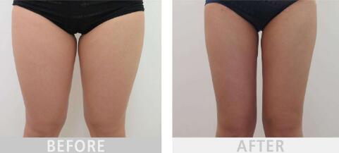 2023年德化縣醫(yī)院整形外科價(jià)目表是否已經(jīng)公布？鄭向陽(yáng)的口碑和經(jīng)驗(yàn)如何進(jìn)行深度評(píng)點(diǎn)？案例欣賞？