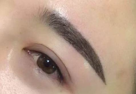 上海薇琳整形醫(yī)院：近期面部吸脂驚艷案例揭秘！