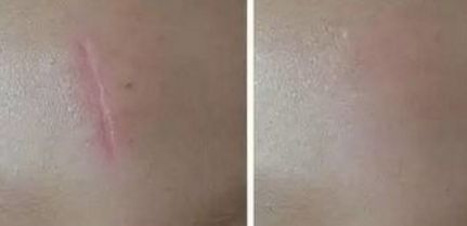 唐毅整形外科醫(yī)生胸部整形術(shù)效果如何？附最新出診信息