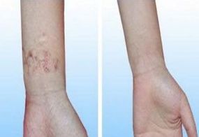 烏魯木齊哪家整形美容醫(yī)院口碑最佳？排行榜公布-專家推薦！