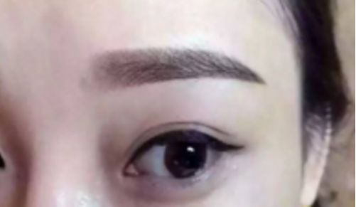 選擇昆明市排名靠前的激光祛斑醫(yī)院，讓你告別煩惱