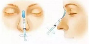 上海五位備受矚目的雙眼皮修復(fù)專家，讓你放心選擇