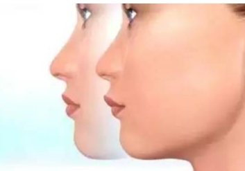 鹽城哪個醫(yī)院的光纖激光治療疤痕效果好？2023年鹽城光纖激光治療疤痕醫(yī)院排名榜TOP10！