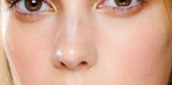 甘肅腫瘤醫(yī)院的口腔科病例圖及矯正價格一覽