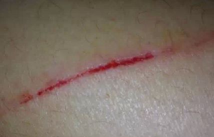 北京聯(lián)合麗格首席醫(yī)生陣容，精選4位超贊吸脂醫(yī)師