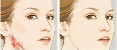 杭州市最受推崇的做雙眼皮手術的頂級醫(yī)院大全，技術高超、口碑出眾一網打盡