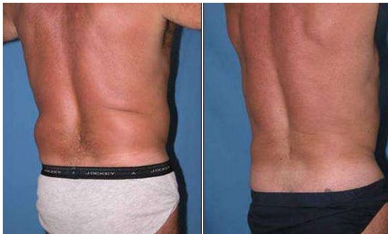 高效而安全的面部提升方法！一覽熱門醫(yī)院推薦榜前七，醫(yī)師實(shí)力和特色詳細(xì)介紹！