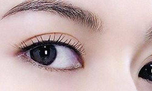 太玲美眸重現(xiàn)！揭秘雙眼皮新趨勢，驚艷效果讓人眼前一亮