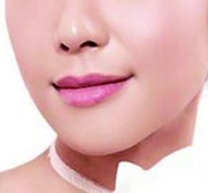 哪位西安醫(yī)生擅長割雙眼皮，割雙眼皮技術(shù)如何？