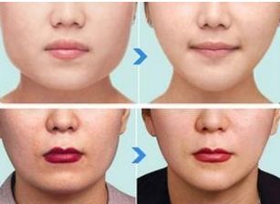 上海排名前十的公立美容醫(yī)院揭秘！技術(shù)、實(shí)力堪比私立！