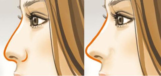 上海哪個醫(yī)院雙眼皮手術(shù)效果最自然？名醫(yī)名單和成功案例供參考