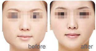 寧波美萊醫(yī)療美容專科的評價如何？全面解析李斌醫(yī)生的口碑反響！