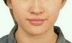 曹衛(wèi)剛vs.張超，比一比！探討九院兩位實(shí)力整形醫(yī)生的特長對比