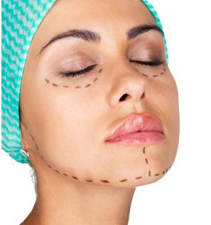 最新資訊！沈干專業(yè)雙眼皮技術揭秘，真實案例解析！