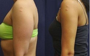 杭州最佳拉皮手術(shù)醫(yī)生盤(pán)點(diǎn)：十位頂尖專家為您揭秘