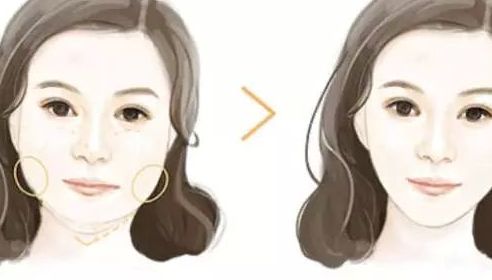 濟(jì)南整形美容醫(yī)院哪家好？諾德、藝星、韓氏躋身手術(shù)排行榜