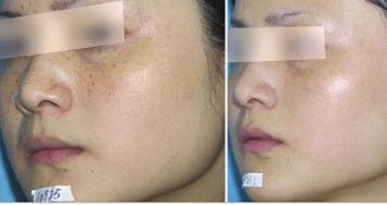 北京隆鼻醫(yī)療專家曝光！汪垟、王博謙、余恩旭等獨特風格值得關注