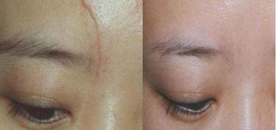 上海九院專業(yè)脂肪填充醫(yī)生排行榜前五名揭曉，想了解的速來！