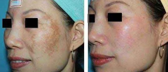 樂山整容醫(yī)院哪家效果好？專業(yè)對(duì)比與推薦！