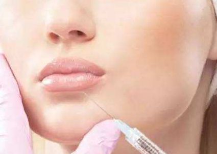 徐占鋒雙眼皮術后效果如何？專業(yè)醫(yī)生簡介及真實案例分享