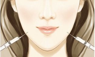 重慶醫(yī)科大學(xué)附屬第一醫(yī)院小蠻腰：雙眼皮手術(shù)無(wú)痛、自然、效果好