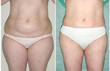 成都優(yōu)質醫(yī)生TOP5：尋覓雙眼皮技藝精湛的專家推薦