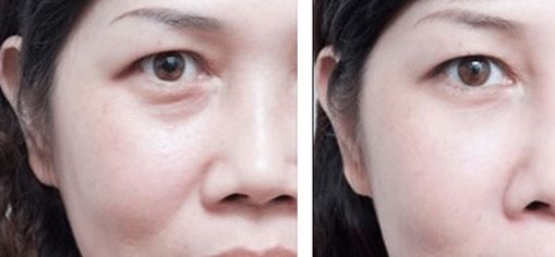 上海治療疤痕的醫(yī)院排名出爐！五家專業(yè)醫(yī)院實力震撼，趕快了解！