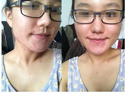 探尋上海最受歡迎的小切口拉皮醫(yī)院，五家名單揭秘！