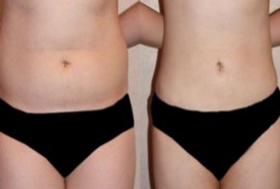 杭州丨醫(yī)美達人投票推薦的前三大整形醫(yī)院，絕對精選