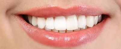 濰坊博雅整形美容醫(yī)院隆鼻案例分享，專業(yè)美容大師為您呈現(xiàn)