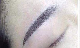 福州弗麗嘉李文信醫(yī)生：鼻部整形經(jīng)驗(yàn)分享