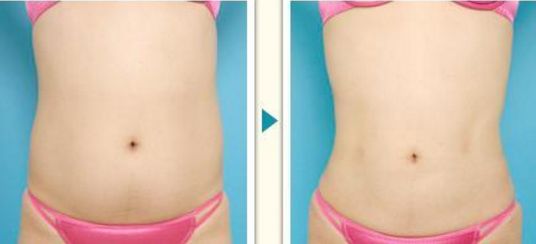 上海脫發(fā)問(wèn)題的首選，哪家技術(shù)在植發(fā)領(lǐng)域名列前茅？重磅推出全新植發(fā)實(shí)力榜！