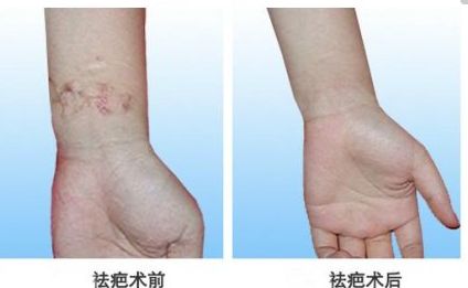 北京自體脂肪隆胸專家真實(shí)排行，專業(yè)技術(shù)精粹一同分享