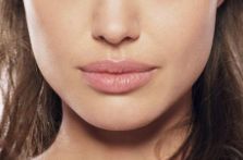 林俊湧醫(yī)師的吸脂手術(shù)技術(shù)及成功案例回顧