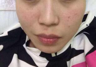 北京藝美醫(yī)療美容診所口碑怎么樣？有哪些值得推薦的醫(yī)生呢？