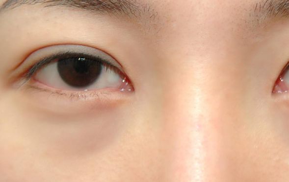 寧波臉部整形領(lǐng)域翹楚！頂尖雙眼皮醫(yī)生大揭秘