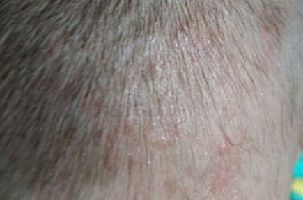 銀川奧蕊斯整形醫(yī)院震驚！驚艷面容煥然一新案例披露