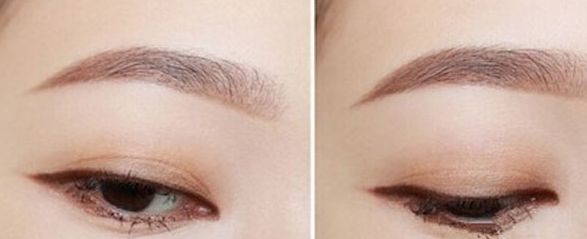 湖北哪家眼科醫(yī)院口碑最佳？這些醫(yī)院實(shí)力雄厚，贏得了廣泛贊譽(yù)。